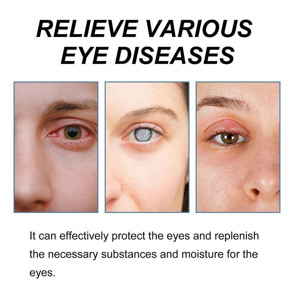 US-Eye Drop Improve Blurred Vision Restore Eyesight Relieve |US*