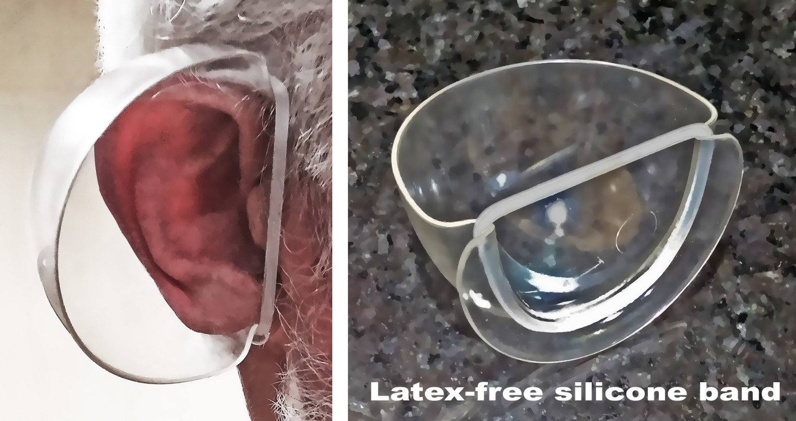 Earglasses® Personal Sound Reflectors, Set of Two Ear Cup Hearing Amplifiers New