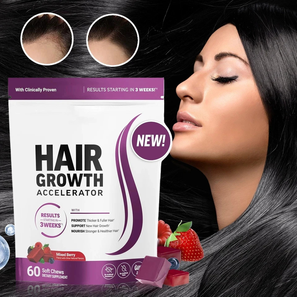 Force Factor Hair Growth Gummies - Supports hair growth and nourishes hair