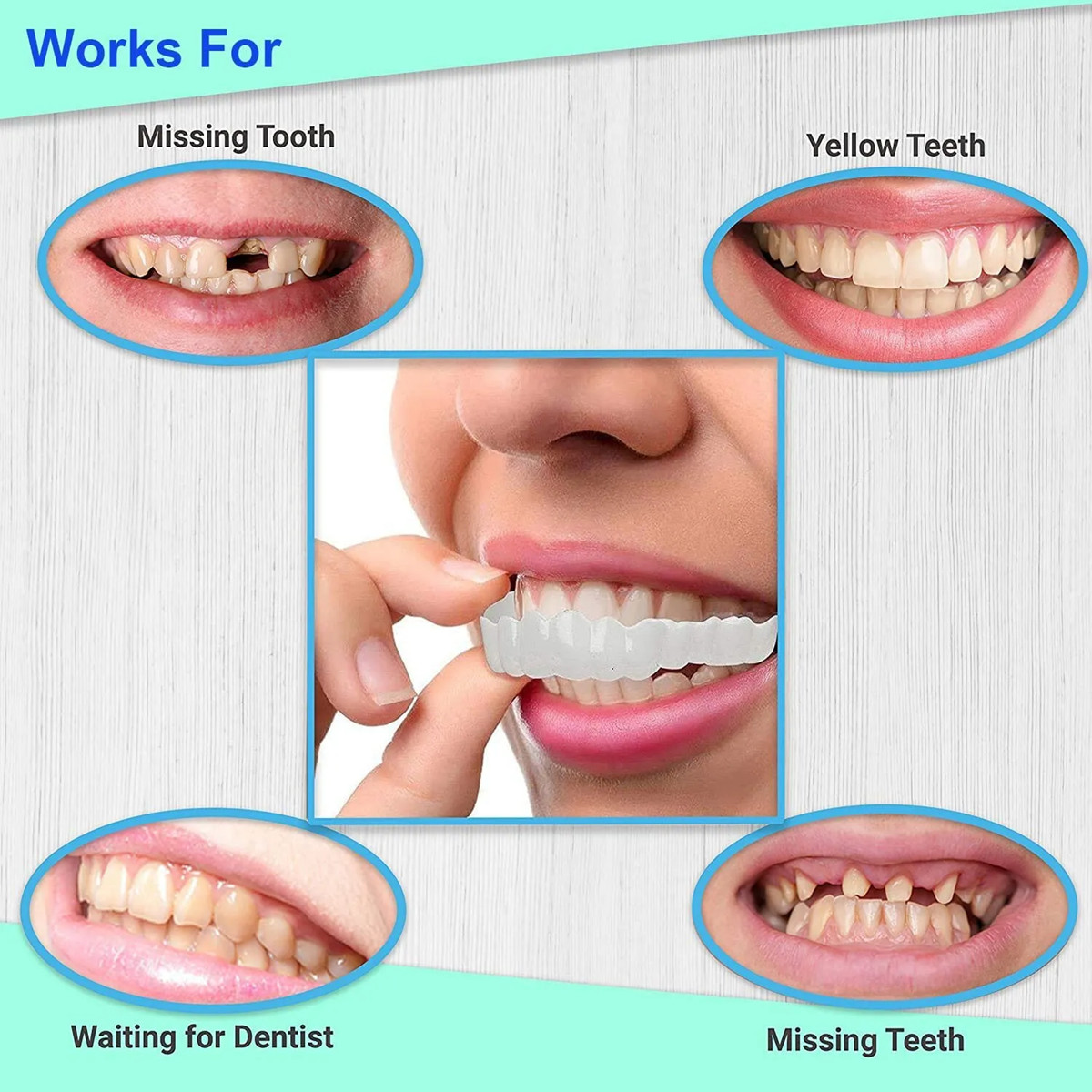 Smile Snap On Upper + Lower False Teeth Dental Veneers Denture Tooth Cover Set