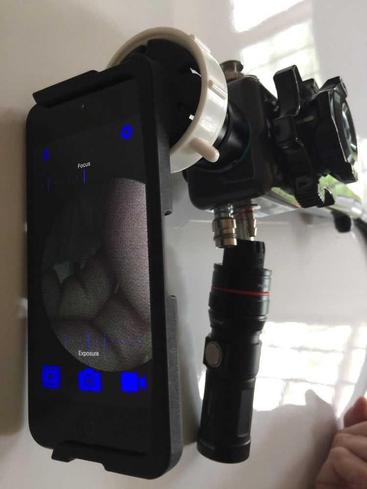 OLYMPUS Flexible Gastroscope 34cm long with light and iPhone adaptor