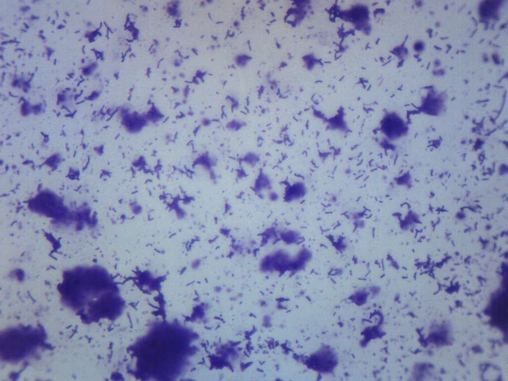 Human Mouth Bacteria, WM - Prepared Microscope Slide - 75x25mm - Eisco Labs
