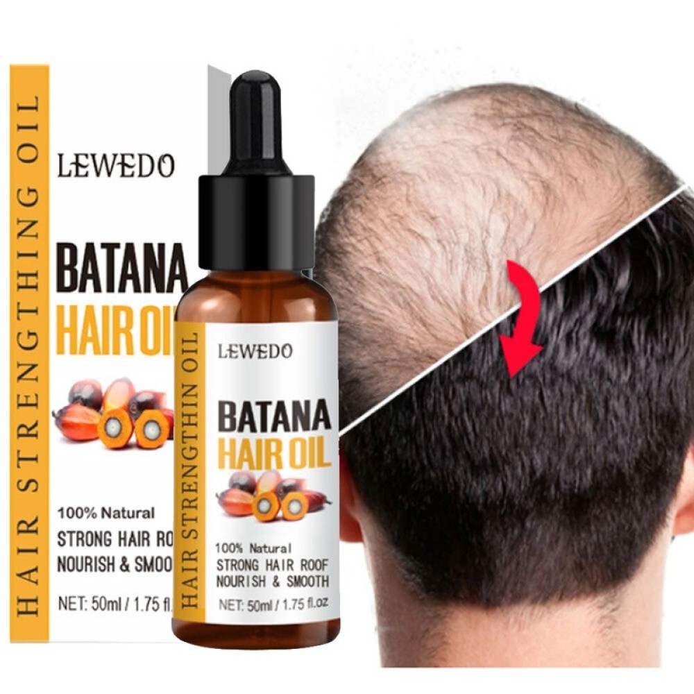 100% Pure Herbal Hair Growth Oil Shampoo Anti hair Loss Hair Regrowth Treatment