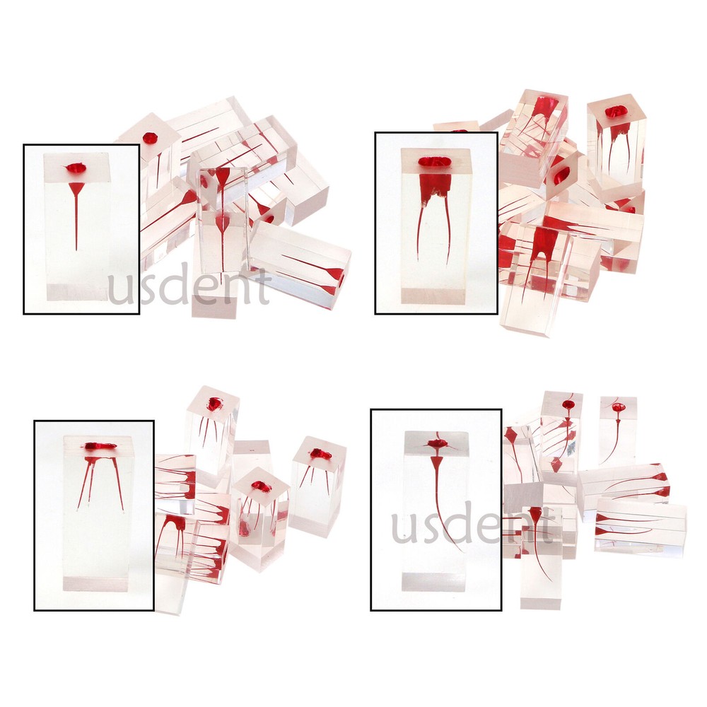 Dental Endo Root Canal Teeth Model Study Practice Block RCT Pulp Cavity