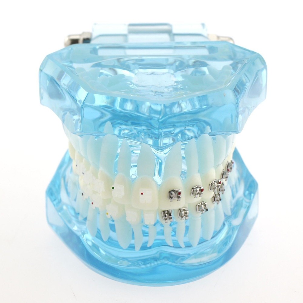 Dental Orthodontic Metal & Ceramic Bracket Brace Teeth Study Teach Model