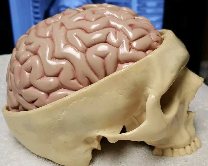 GPI Brain/ Partial Skull Model