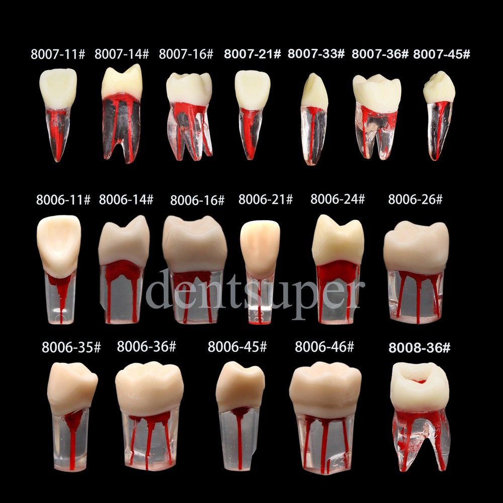 Dental Teeth Root Canal RCT Block Pulp Cavity Practice Model for Endo File Study