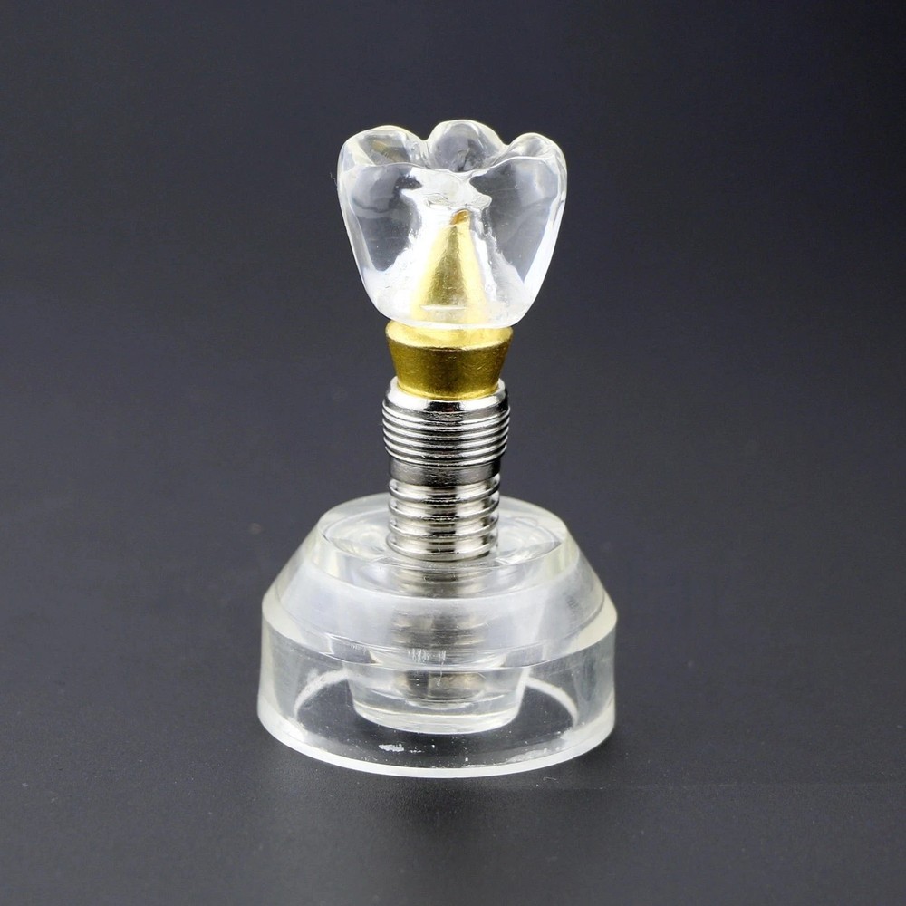 M2020 Dental Implant Model Teeth Study Teach Model Removable Clear Demonstration