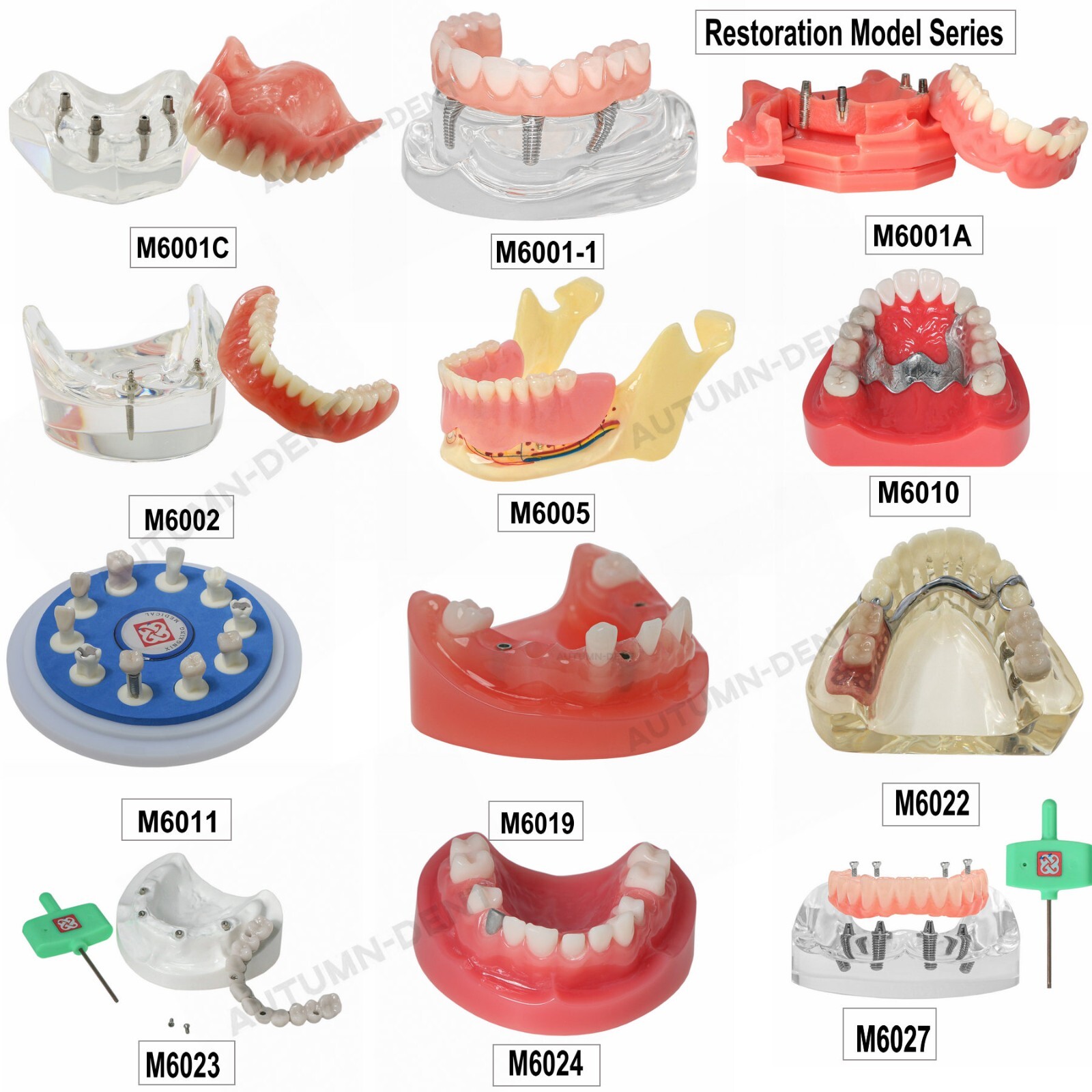 Dental Implant Typodont Teeth Restoration Model Series Overdenture Practice Demo