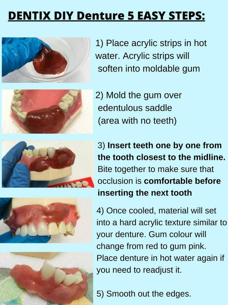 DIY Denture Kit Immediate Partial Denture, Full Denture Upper OR Lower NO MOLD