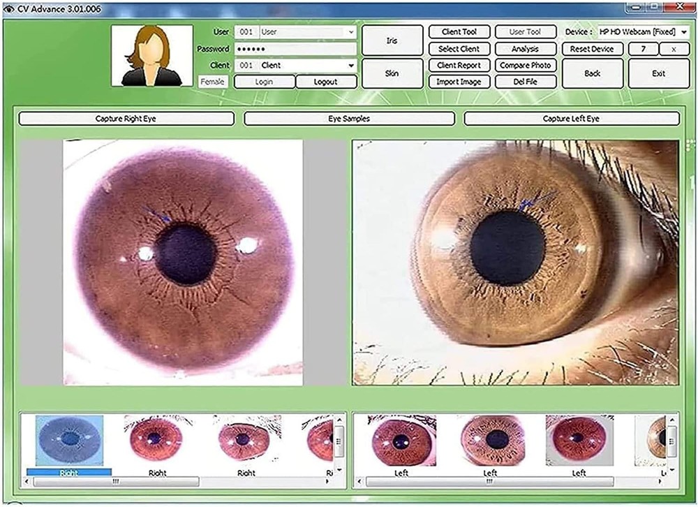 5.0MP USB Iris Analyzer Iridology Camera, 30x Iris Analysis Camera Analyzer Tool