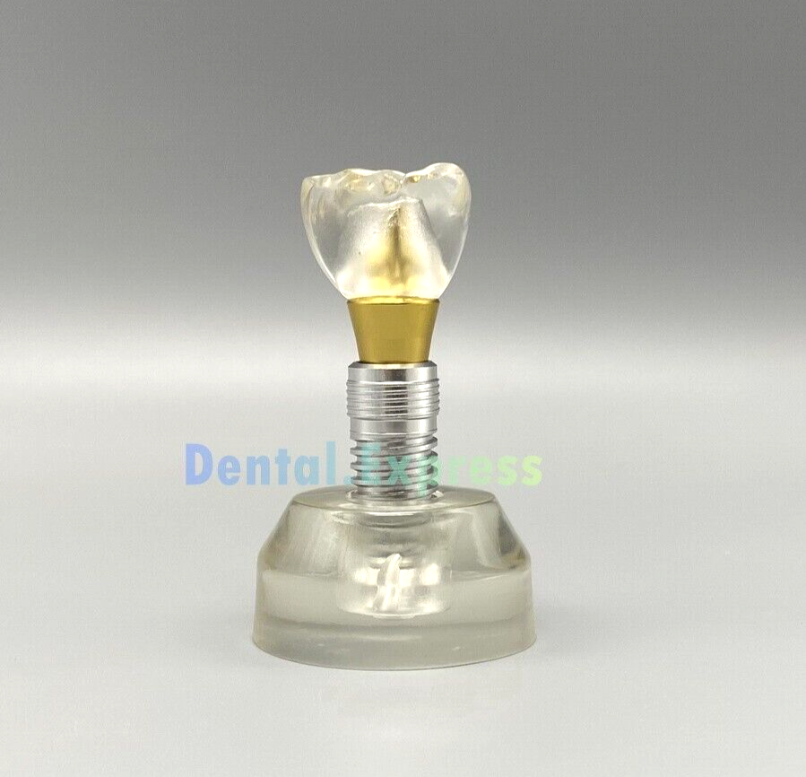 M2020 Dental Implant Model Demonstration Teeth Study Teaching Models Detachable