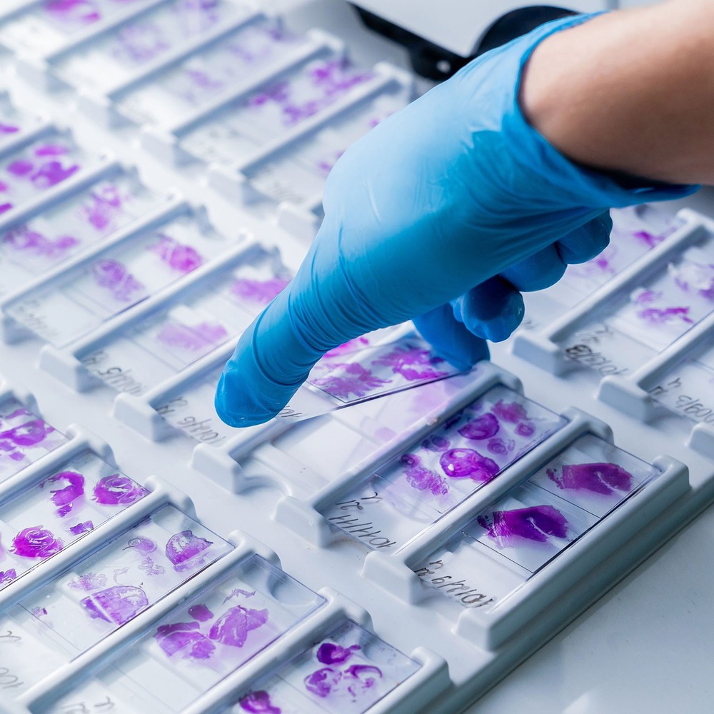 200pcs Cover Slips for Microscope Slides, 24x50mm Microscope Cover Rectangle