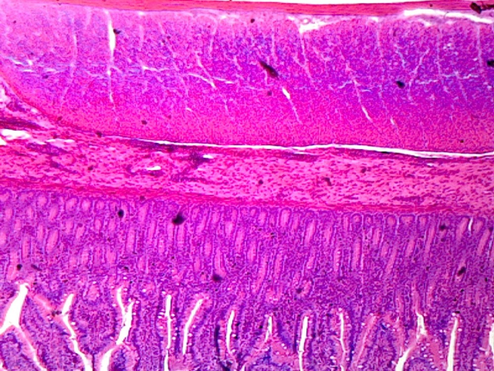 Smooth Muscle, Mammalian; Cross Section