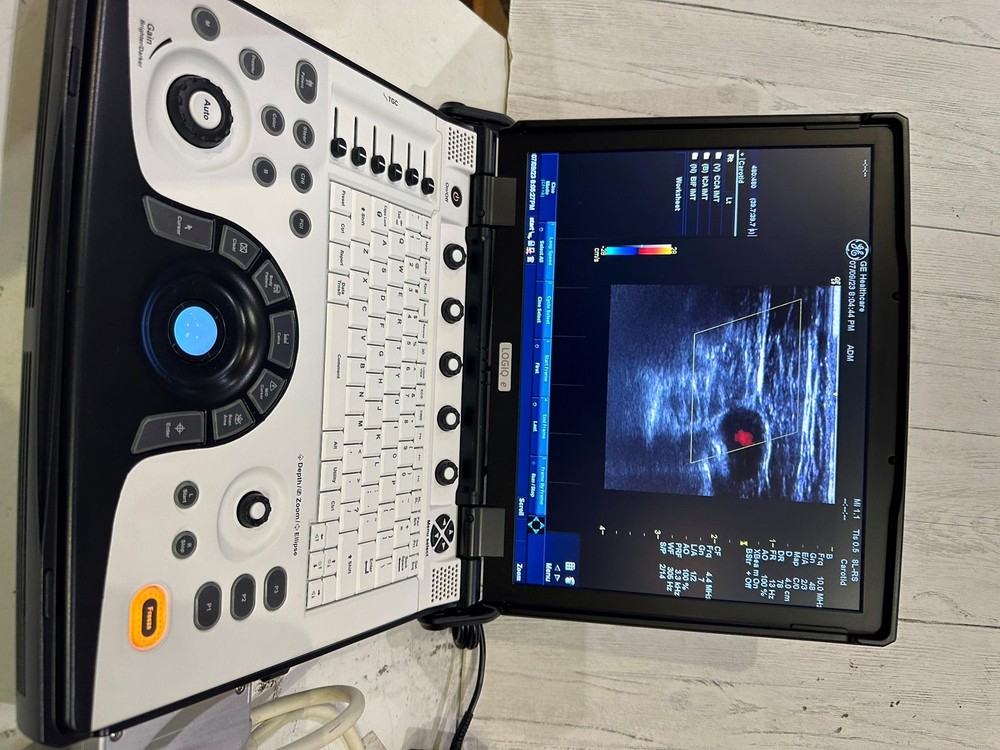 GE LOGIQ E Next Generation Ultrasound BT12 DOM 2012