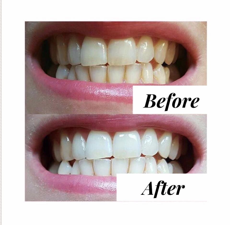 Nuskin AP-24 Whitening Fluoride Toothpaste