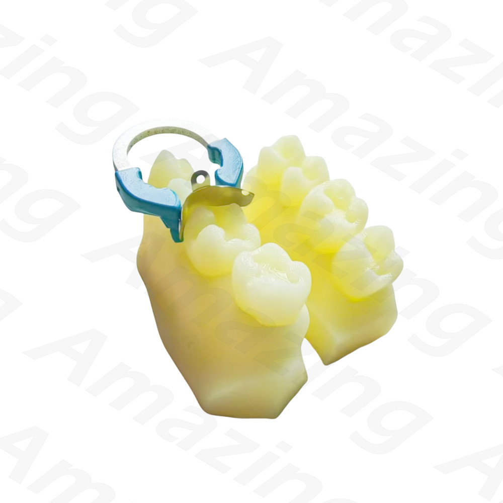 Dental Caries Decay Teeth Model Composite Resin Restore Tooth Simulate Class II