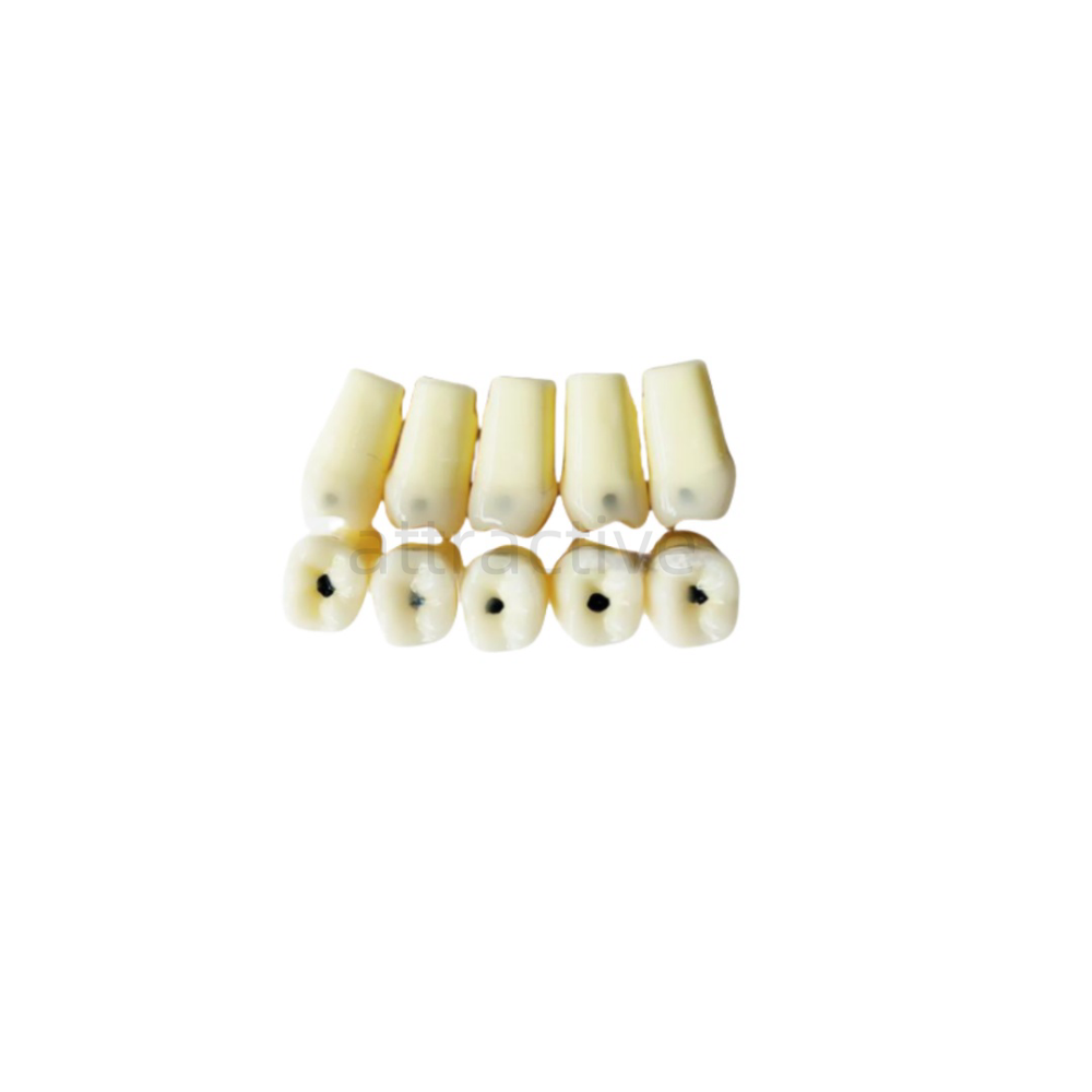 Dental Molar/Front Vitro Teeth Decay Caries Tooth Model Dentist Student Practise