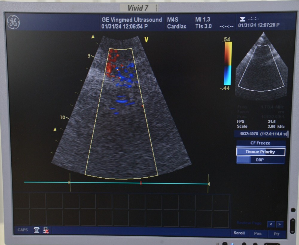 GE M4S Cardiac Sector Array 5129041