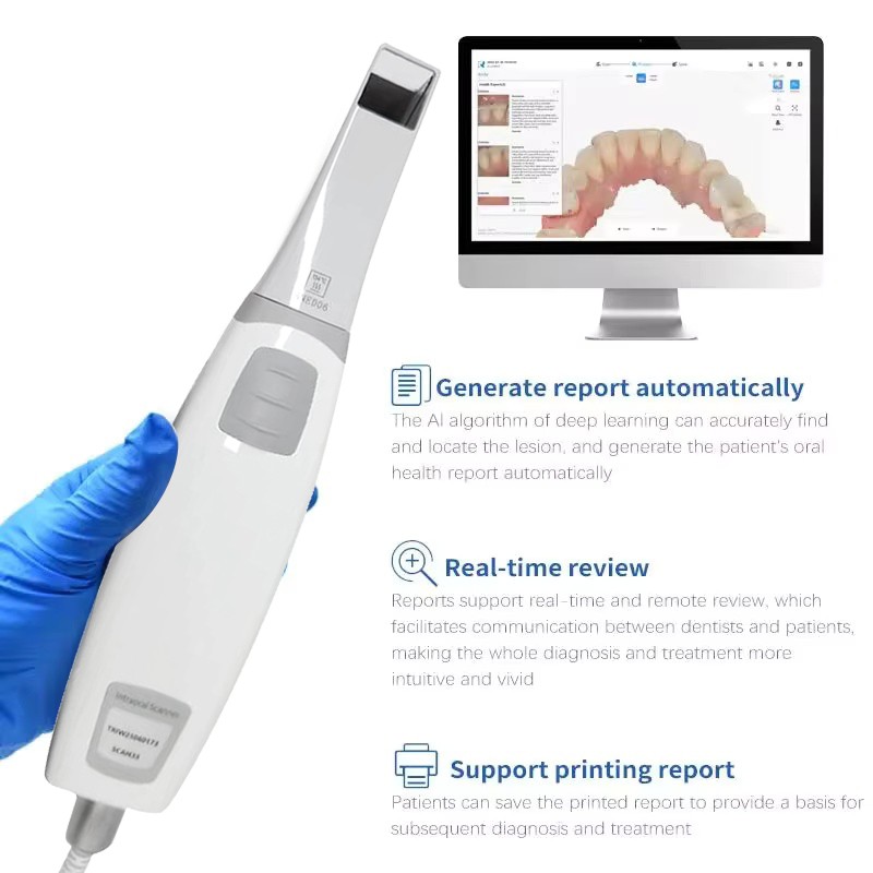 Dental Intraoral Scanner 3D Real-time Display With Scanning Software