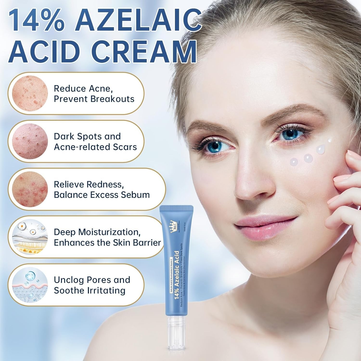 Azelaic Acid 14% Acne Cream for Redness Relief, Dark Spots, Facial Serum with Ni