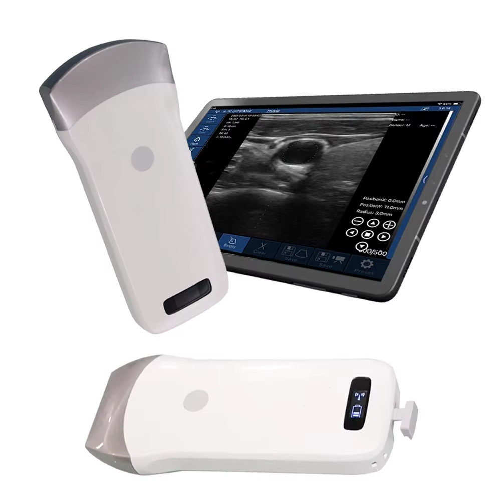 Wireless Ultrasound Probe Scanner Portable Machine Support iOS Android Windows