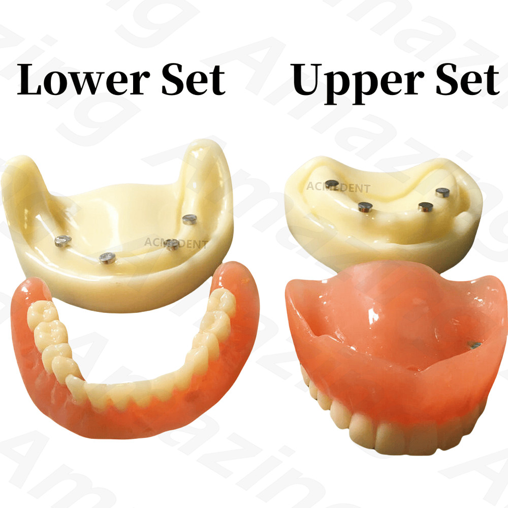 Dental Full Denture Model Overdenture Magnetic Attachment Mandibular Upper Study