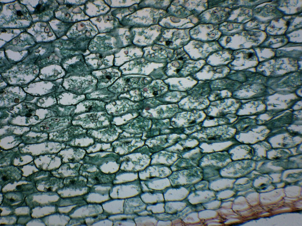 Solanum Tuber Section - Prepared Slide - 75x25mm - Eisco Labs