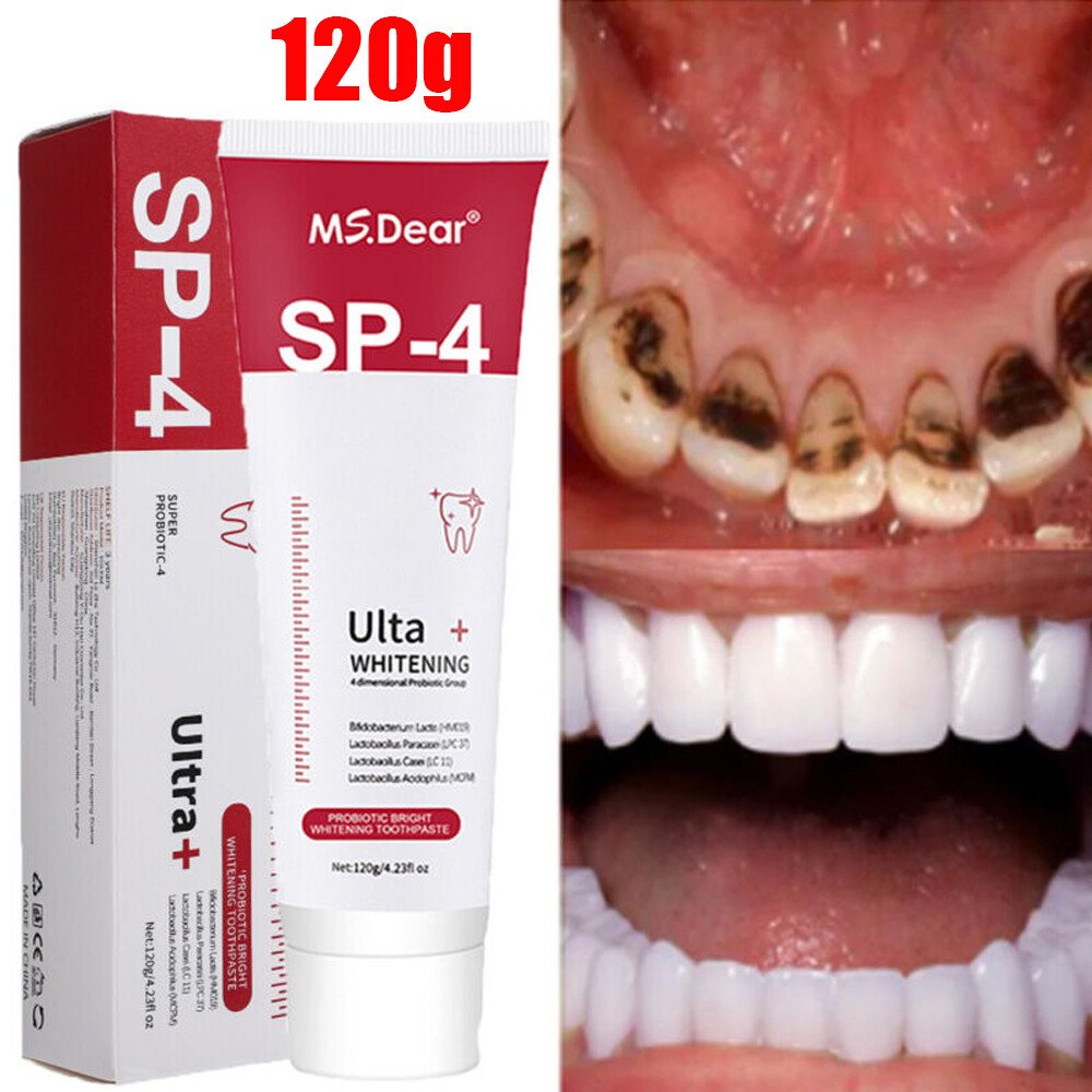 3Pcs SP-4 Probiotic Toothpaste, Sp-4 Toothpaste Whitening ,Remove yellow teeth