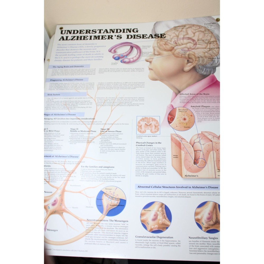 Wolters Kluwer Understanding Alzheimers Disease Chart Schematic 91285