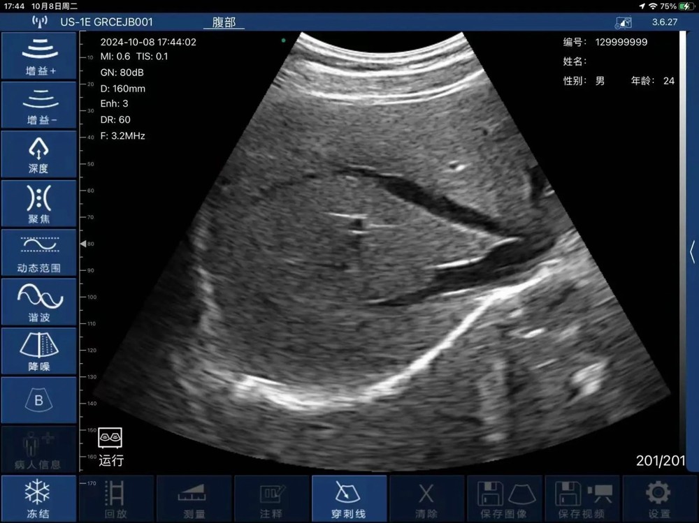 Portable 96E Wireless Ultrasound Scanner Machine w/ Convex Array Probe