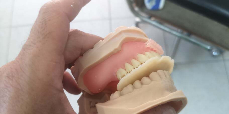 DLP SLA LCD 3d printer denture base resin for manufacturing dentures