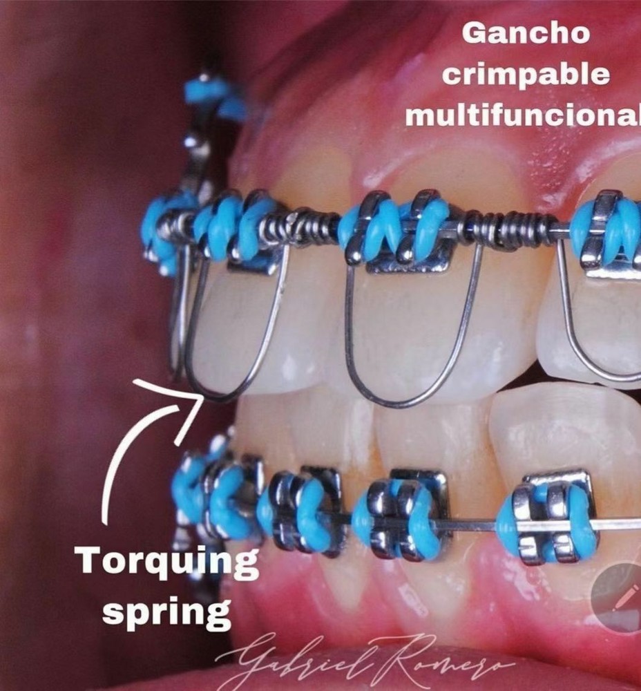 10pcs Dental Ortho Torquing Torque Spring Rectangular wire Single Anterior Teeth