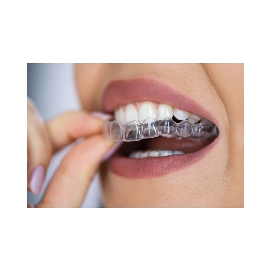Clear Dental Resin for Splints/Guards - Biocompatible | ISO Certified | USA