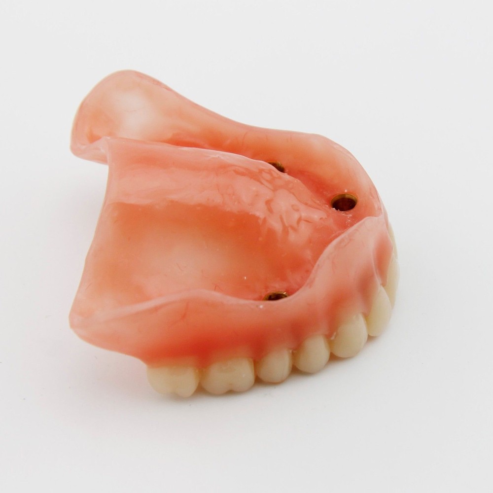 Dental Implant Teeth Model Demo Overdenture Restoration Teaching Study 4 Models