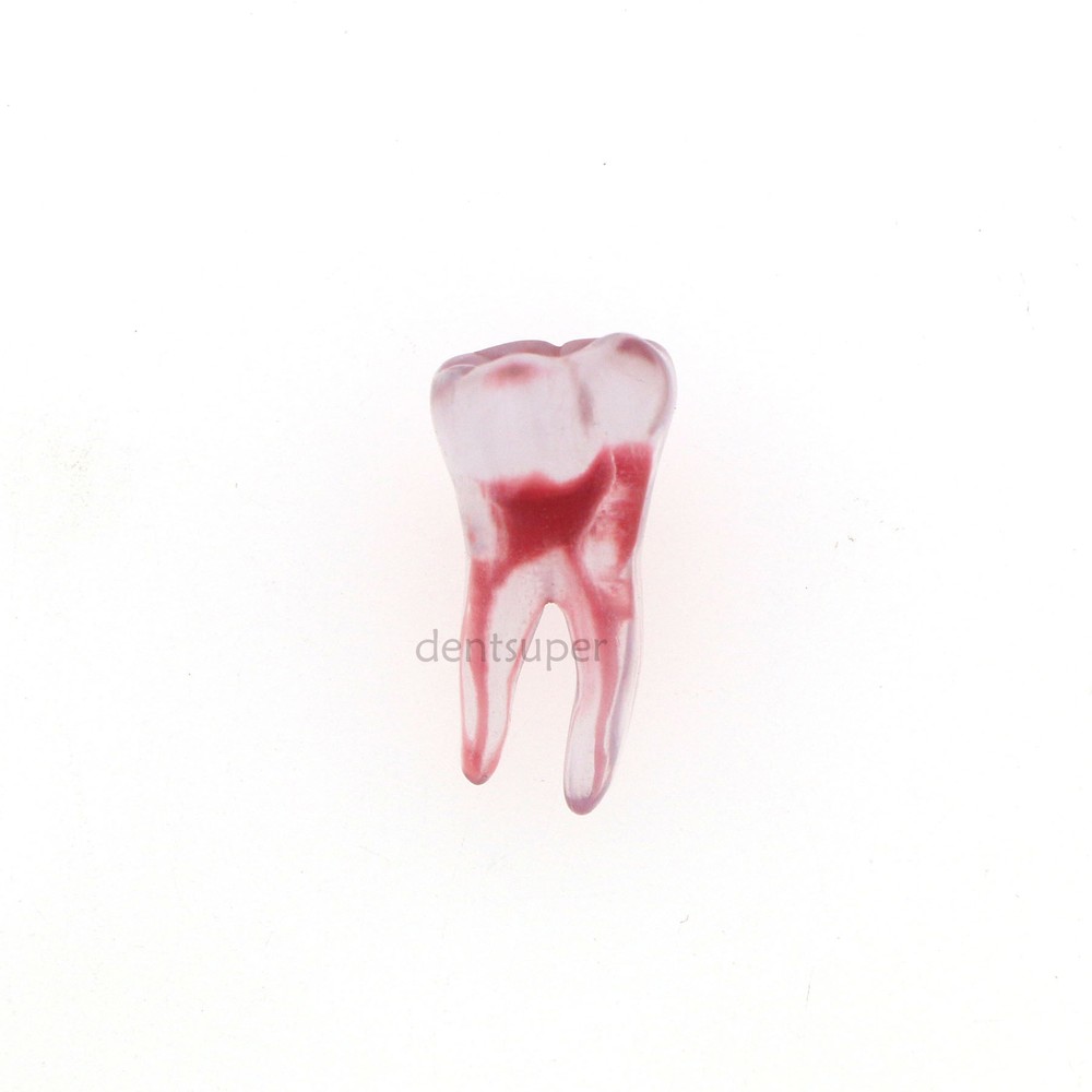 3D Dental Endo Root Canal Teeth Model Practice Block for RCT Pulp Cavity Study