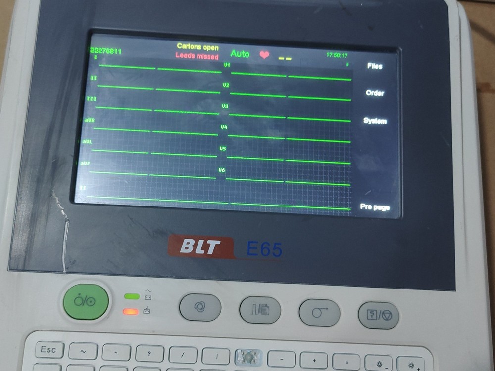 electrocardiograph Digital Biolight E65 ECG Machine 12 Channel ECG Machine