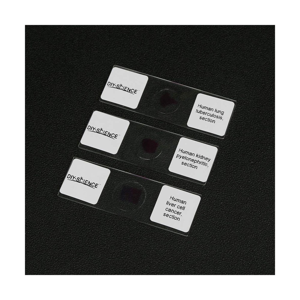 Prepared Human Pathology Microscope Slide Set, 12pcs Research-Quality Prepare...
