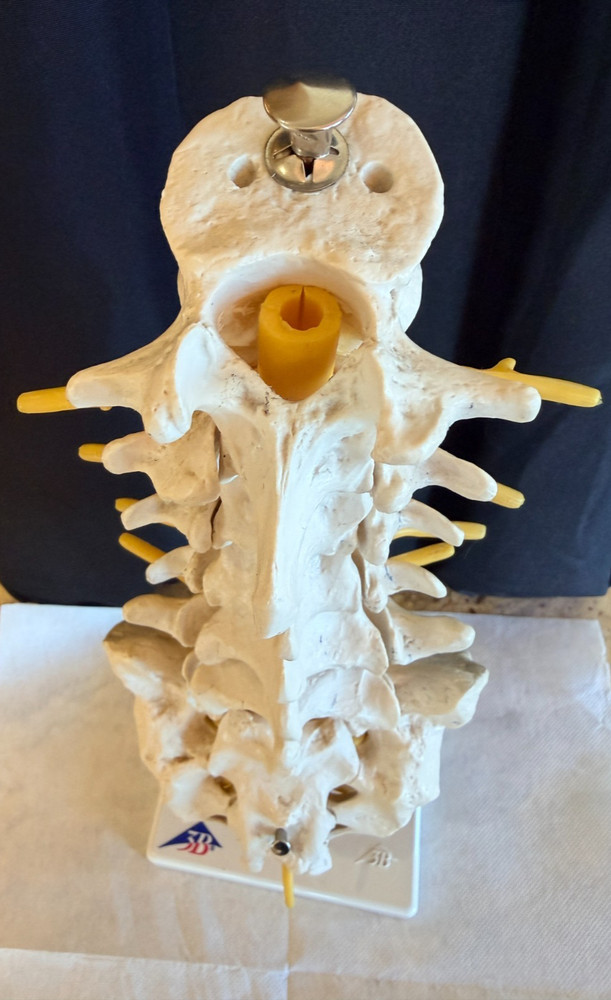 Lumbar Spine Model A74 - 3B Scientific