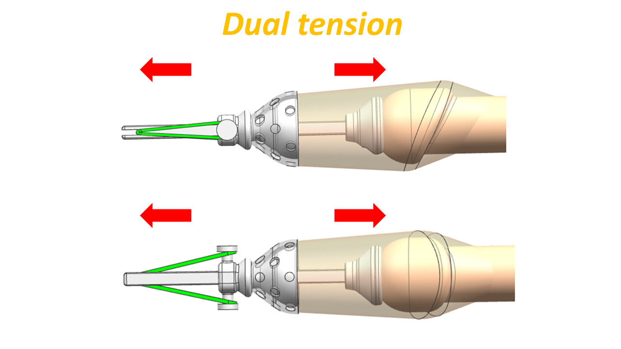 Foreskin restoration ETR(Elastic Tension Restorer) and Retainer