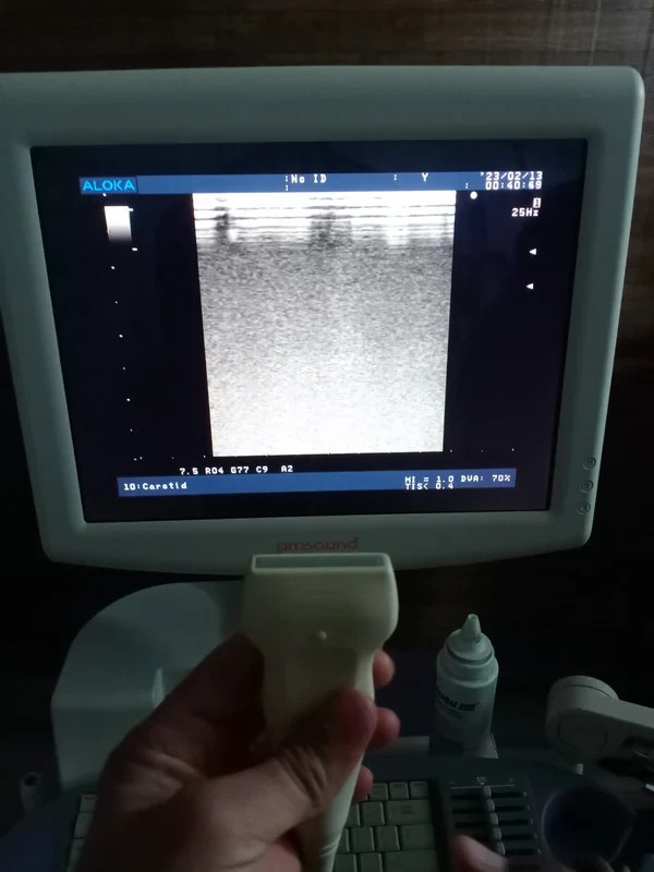 ..aloka UST-5546 linear probe checked dxb