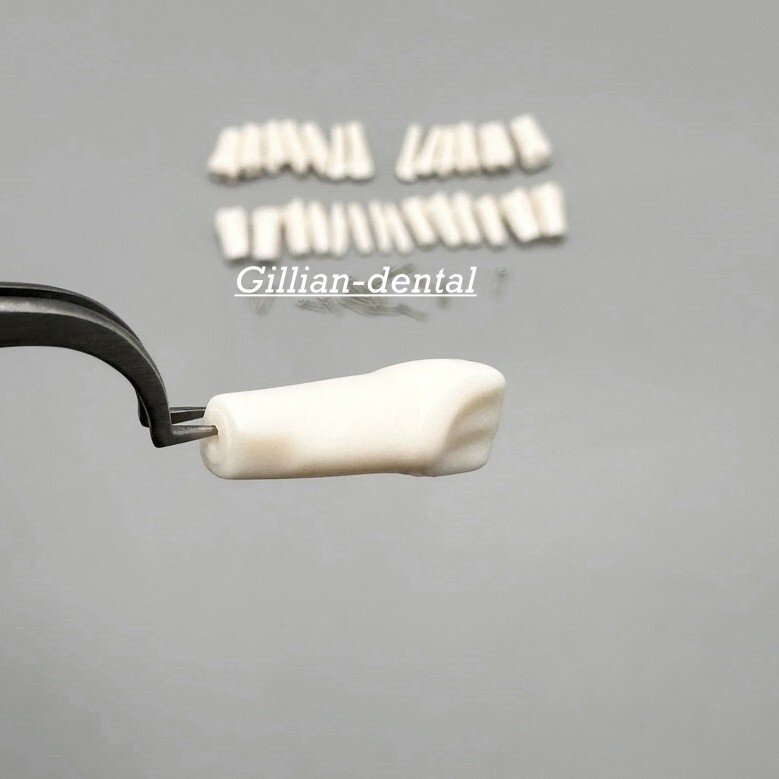 Dental Replacement Screw-in Teeth Typodont Model Practice Removable Tooth Models