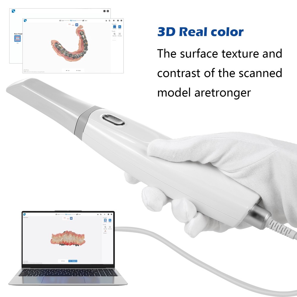 Dental Intra oral Scanner Remote sensing function AI Scanning Software+4 Tips S5