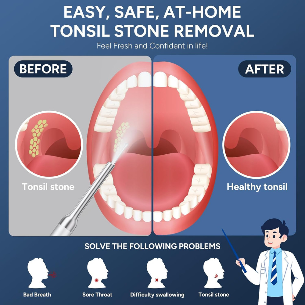 Tonsil Stone Remover with Camera - Upgraded Visual Tonsil Stone Removal Kit with