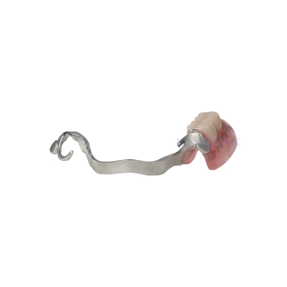 Dental Typodont Restoration Teeth Model With Partial Denture Demo 2 Implants