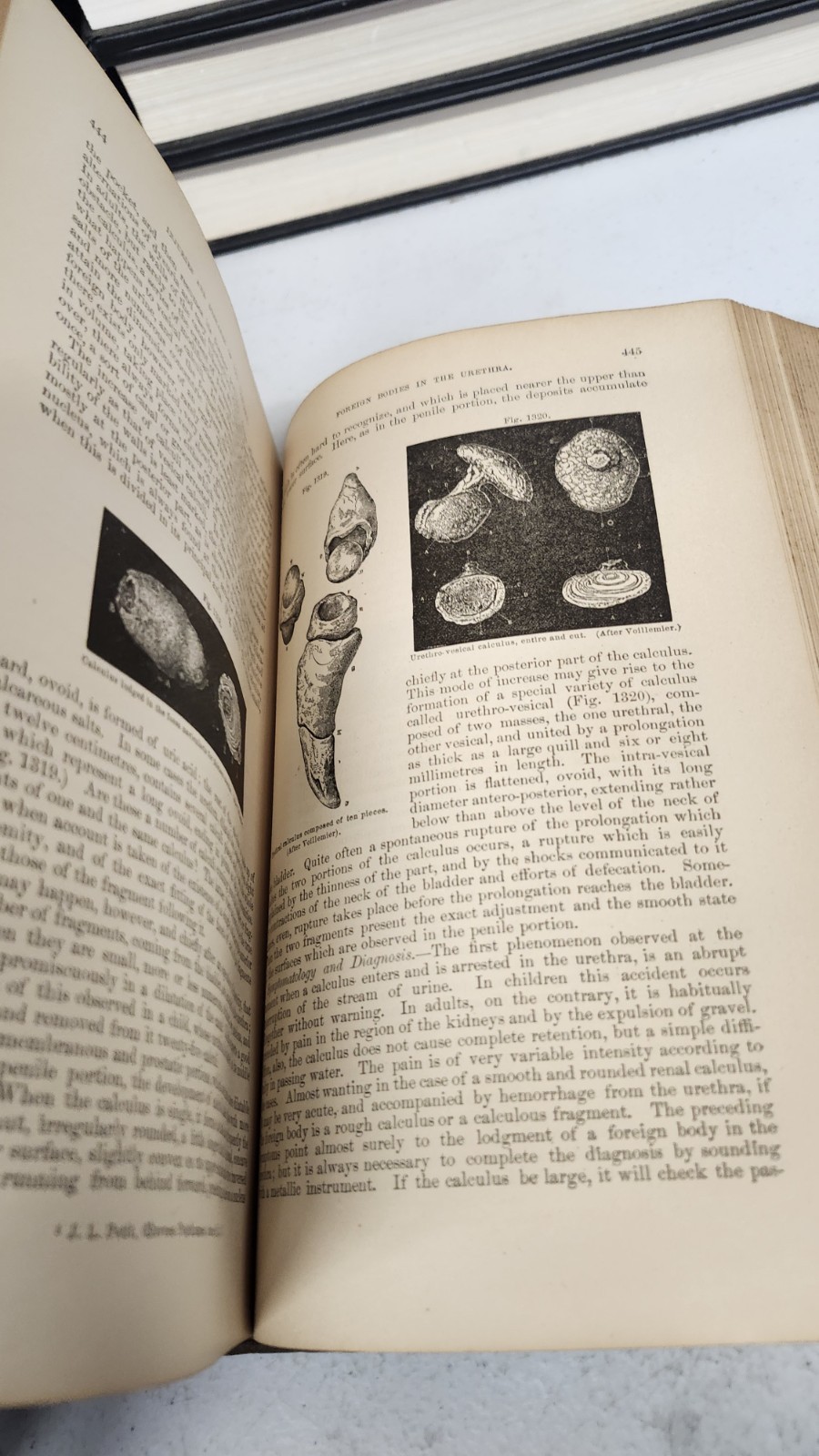 1886 International Encyclopaedia of Surgery John Ashhurst Jr Vol VI