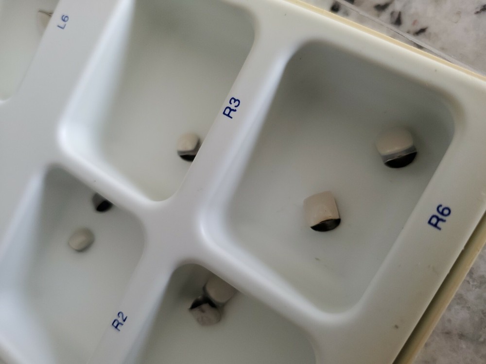 White Bite Inc Pediatric Crowns