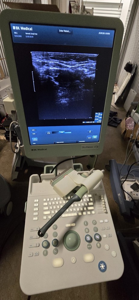 vascular venous ultrasound machine portable