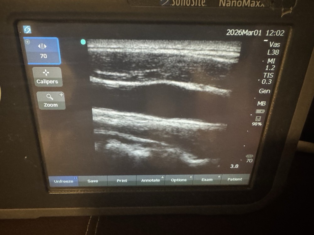 SonoSite L38n/10-5 MHz Linear Array Transducer Probe