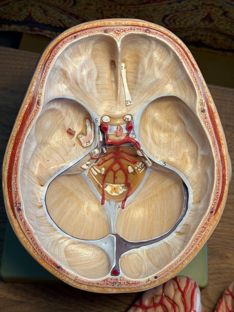 SOMSO Head, Brain, Cranial Nerves, Basilar Artery Model